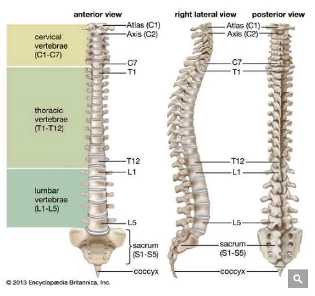 Twenty Year Of Migraines And Low Back Pain Totally Resolved ICNR