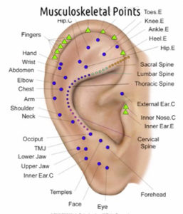 Ear Piercings can be a Source of Depression - ICNR